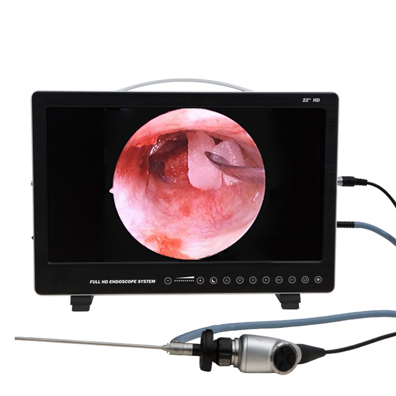 Laptop Accessories All In One - Système de caméra endoscopique Full HD